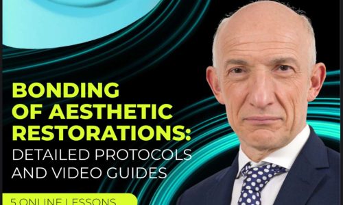 👉Bonding of Aesthetic Restorations: Detailed Protocols and Video Guides
