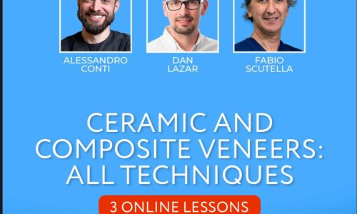 👉Ceramic And Composite Veneers: All Techniques
