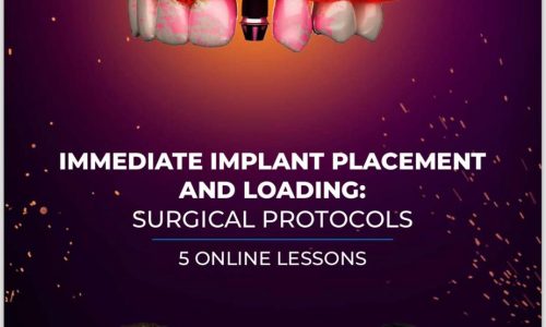 👉Immediate Implant Placement. Everything you need to know