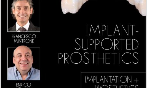 👉Full-Arch Rehabilitation. Implantation and Prosthetics