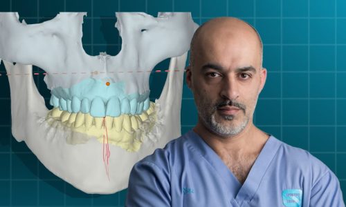 👉Digital Occlusion and Rehabilitation: from Т-scan analysis to full mouth rehabilitation