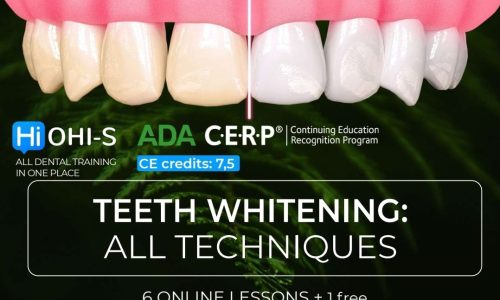 👉Teeth Whitening: All Techniques